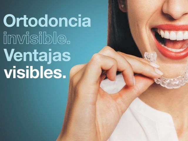Ortodoncia Invisible